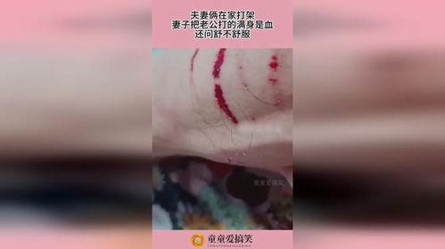 满身是血的图片,惊心动魄的瞬间